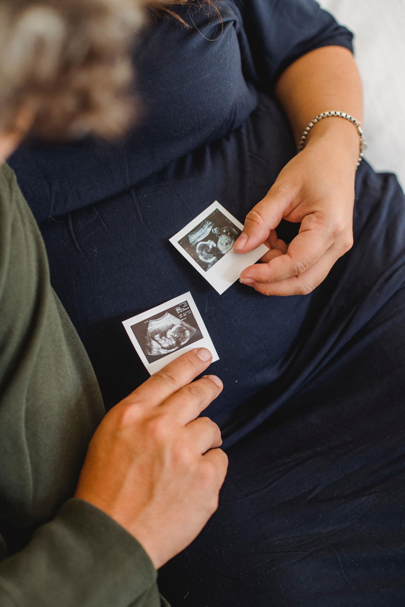 Foto von zwei Personen, die ein Ultraschallbild betrachten